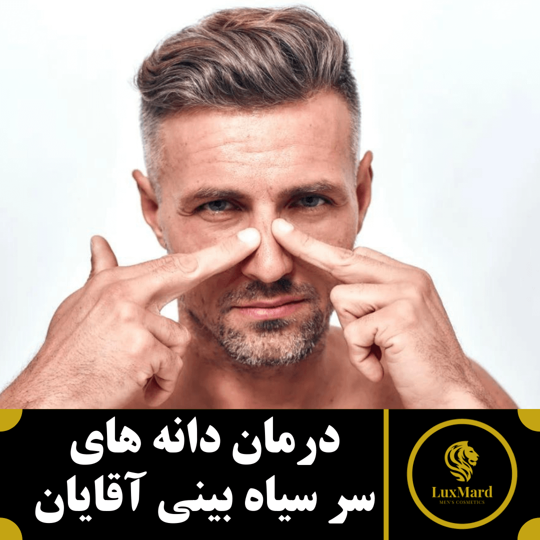 درمان دانه های سر سیاه بینی آقایان