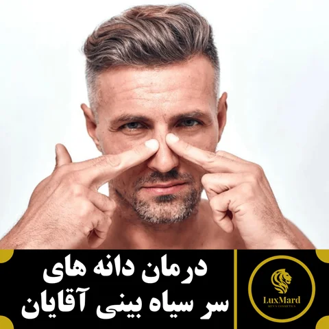 درمان دانه های سر سیاه بینی آقایان