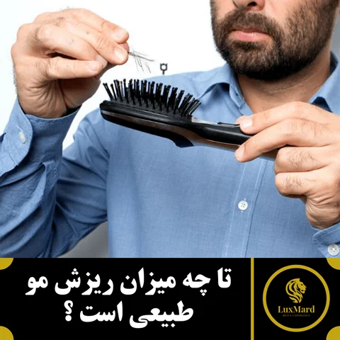 تا چه میزان ریزش مو طبیعی است ؟