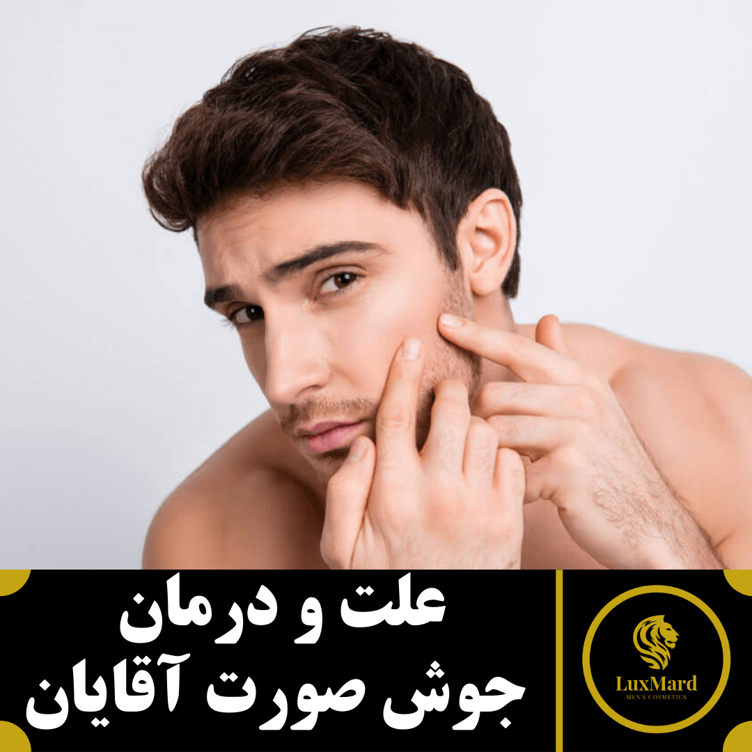 علت و درمان جوش صورت آقایان