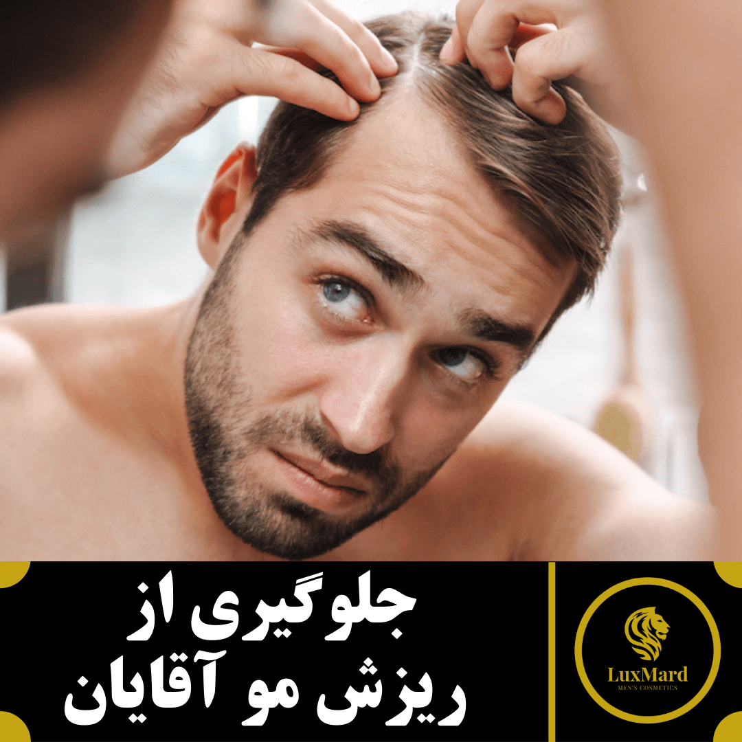 جلوگیری از ریزش مو آقایان