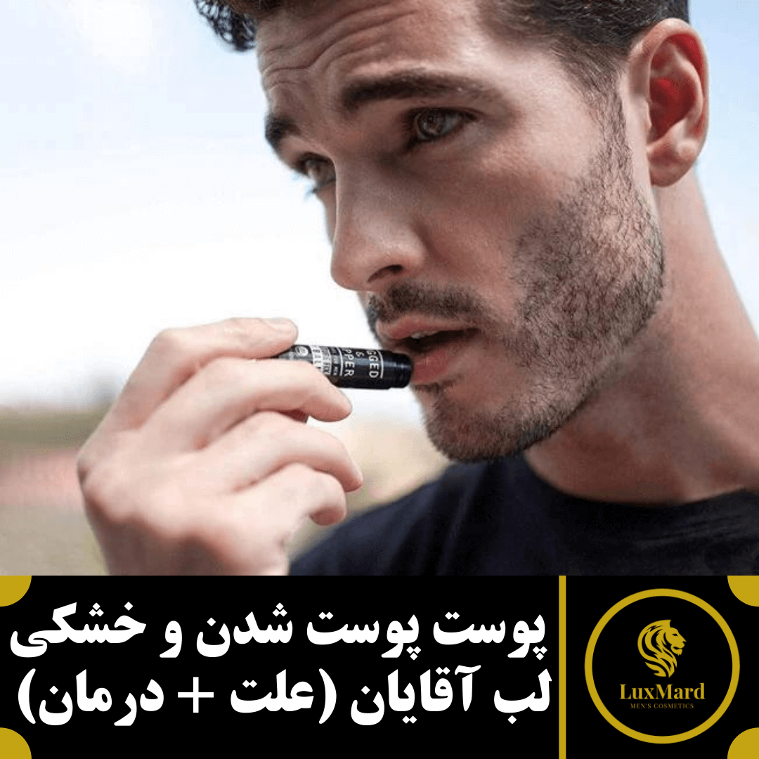 علت و درمان خشکی لب آقایان